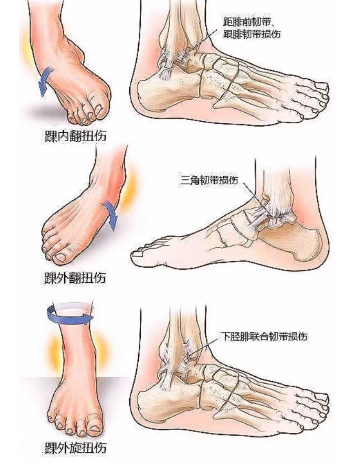 云达不莱梅前锋脚踝受伤，愈后康复缓慢